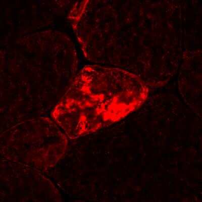 Immunohistochemistry-Frozen: FLNC Antibody [NBP1-89300]