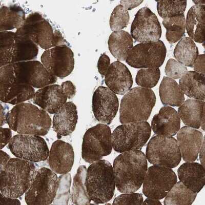 Immunohistochemistry-Paraffin: FLNC Antibody [NBP1-89300]