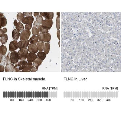 Immunohistochemistry-Paraffin: FLNC Antibody [NBP1-89300]