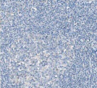 Immunohistochemistry-Paraffin: FLNC Antibody [NBP1-89300]