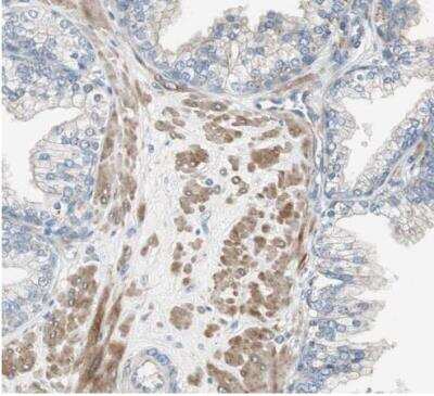 Immunohistochemistry-Paraffin: FLNC Antibody [NBP1-89300]