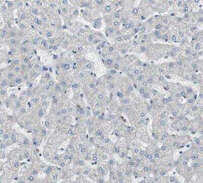 Immunohistochemistry-Paraffin: FLNC Antibody [NBP1-89300]