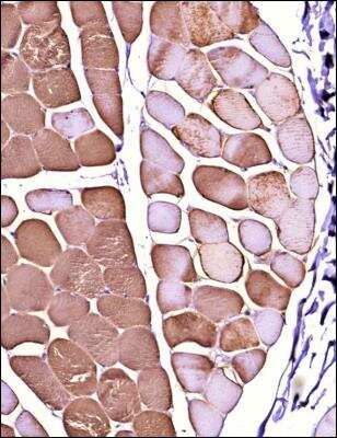 Immunohistochemistry-Paraffin: FLNC Antibody - BSA Free [NBP2-79816]