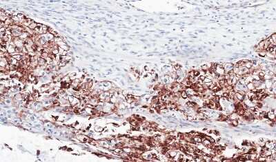 Immunohistochemistry-Paraffin: FLRT1 Antibody [NBP1-31403]