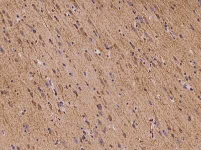 Immunohistochemistry-Paraffin: FLRT1 Antibody [NBP2-97173]