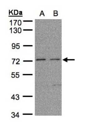 Western Blot: FLRT1 Antibody [NBP1-31403]