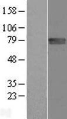 Western Blot: FLRT1 Overexpression Lysate [NBL1-10771]