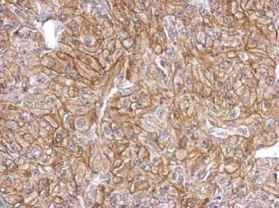 Immunohistochemistry-Paraffin: FLRT2 Antibody [NBP2-43653]