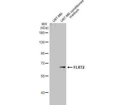 Western Blot: FLRT2 Antibody [NBP2-43653]