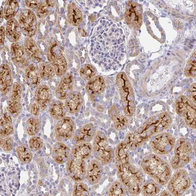 Immunohistochemistry-Paraffin: FLRT3 Antibody [NBP2-38778]