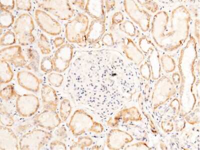 Immunohistochemistry-Paraffin: FLRT3 Antibody [NBP2-99728]