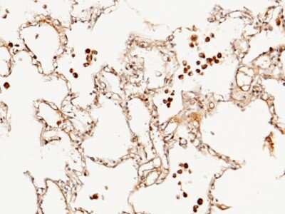 Immunohistochemistry-Paraffin: FLRT3 Antibody [NBP2-99728]