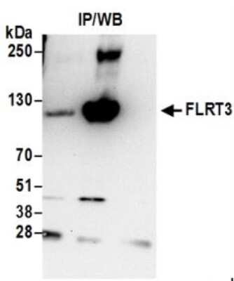 Immunoprecipitation: FLRT3 Antibody [NBP2-36566]