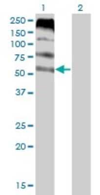 Western Blot: FLVCR Antibody (4B2) [H00028982-M05]