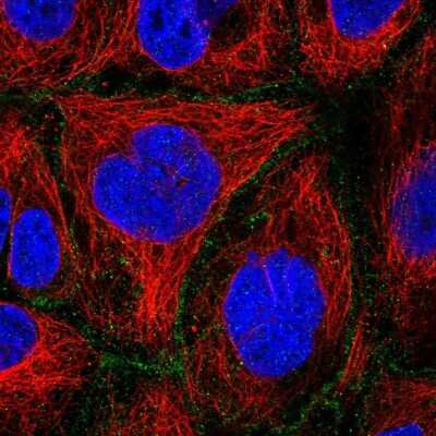 Immunocytochemistry/ Immunofluorescence: FLVCR Antibody [NBP2-14019]