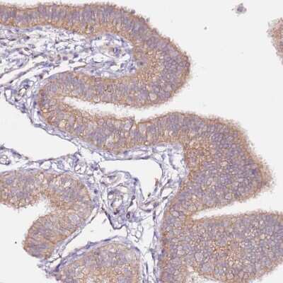Immunohistochemistry-Paraffin: FLVCR Antibody [NBP2-14019]