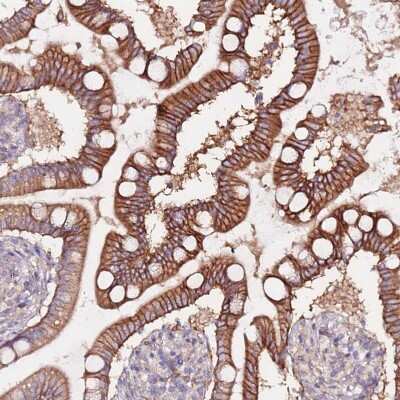 Immunohistochemistry-Paraffin: FLVCR Antibody [NBP2-14019]