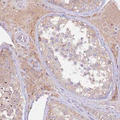 Immunohistochemistry-Paraffin: FLVCR Antibody [NBP2-14019]