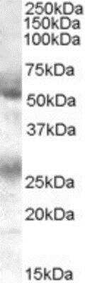 Western Blot: FLVCR Antibody [NB100-1481]