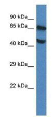 Western Blot: FLVCR Antibody [NBP1-91456]