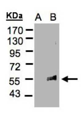 Western Blot: FLVCR Antibody [NBP2-16509]