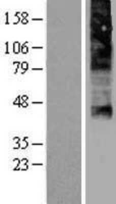 Western Blot: FLVCR Overexpression Lysate [NBP2-04342]