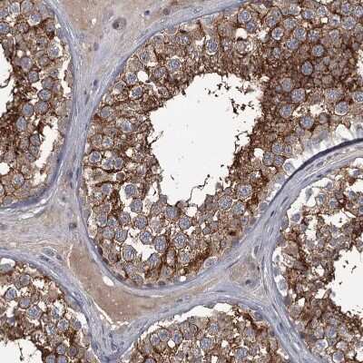 Immunohistochemistry-Paraffin: FLVCR2 Antibody [NBP1-94146]