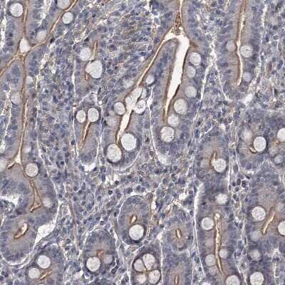 Immunohistochemistry-Paraffin: FLVCR2 Antibody [NBP1-94146]