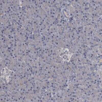 Immunohistochemistry-Paraffin: FLVCR2 Antibody [NBP1-94146]