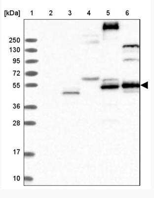 Western Blot: FLVCR2 Antibody [NBP1-94146]