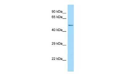 Western Blot: FLVCR2 Antibody [NBP2-82807]