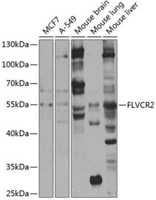 Western Blot: FLVCR2 AntibodyBSA Free [NBP3-04394]