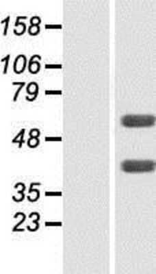 Western Blot: FLVCR2 Overexpression Lysate [NBP2-06917]