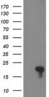 Western Blot: FLYWCH2 Antibody (OTI3G3) [NBP2-00646]