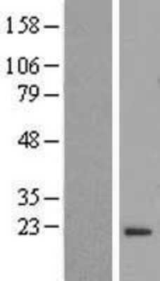 Western Blot: FLYWCH2 Overexpression Lysate [NBP2-09650]