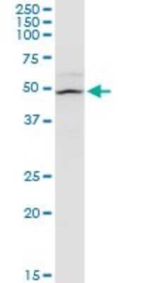 Western Blot: FMN1 Antibody (4F4) [H00342184-M07]