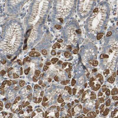 Immunohistochemistry-Paraffin: FMN1 Antibody [NBP2-48499]