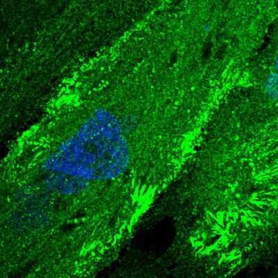 Immunocytochemistry/ Immunofluorescence: FMN2 Antibody [NBP2-58041]