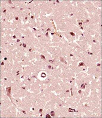 Immunohistochemistry-Paraffin: FMN2 Antibody [NBP2-24615]