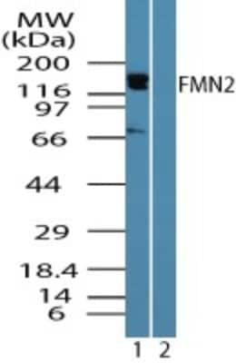 Western Blot: FMN2 Antibody [NBP2-24615]