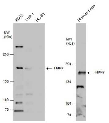 Western Blot: FMN2 Antibody [NBP3-12998]