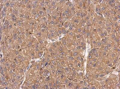 Immunohistochemistry-Paraffin: FMNL1 Antibody [NBP1-33431]