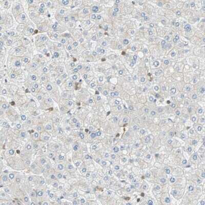 Immunohistochemistry-Paraffin: FMNL1 Antibody [NBP1-88460]