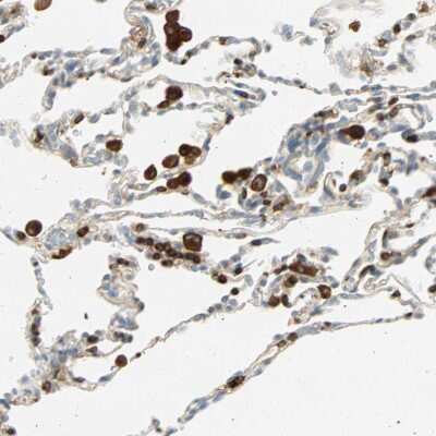 Immunohistochemistry-Paraffin: FMNL1 Antibody [NBP1-88460]
