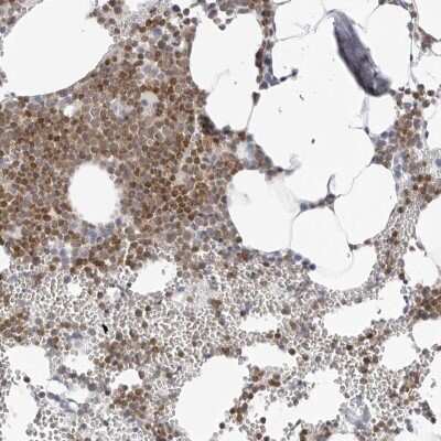Immunohistochemistry-Paraffin: FMNL1 Antibody [NBP1-88461]