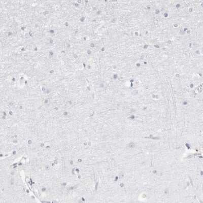 Immunohistochemistry-Paraffin: FMNL1 Antibody [NBP1-88461]