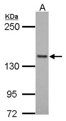 Western Blot: FMNL1 Antibody [NBP1-33431]