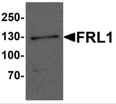 Western Blot: FMNL1 AntibodyBSA Free [NBP2-81988]