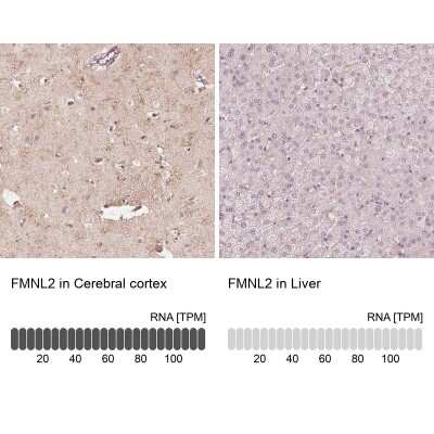 Immunohistochemistry-Paraffin: FMNL2 Antibody [NBP1-83901]