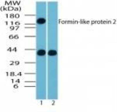 Western Blot: FMNL2 Antibody [NBP2-24748]